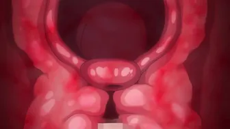 Boku Ni Sefure Ga Dekita Riyuu The Animation EP 6 (60fps)
